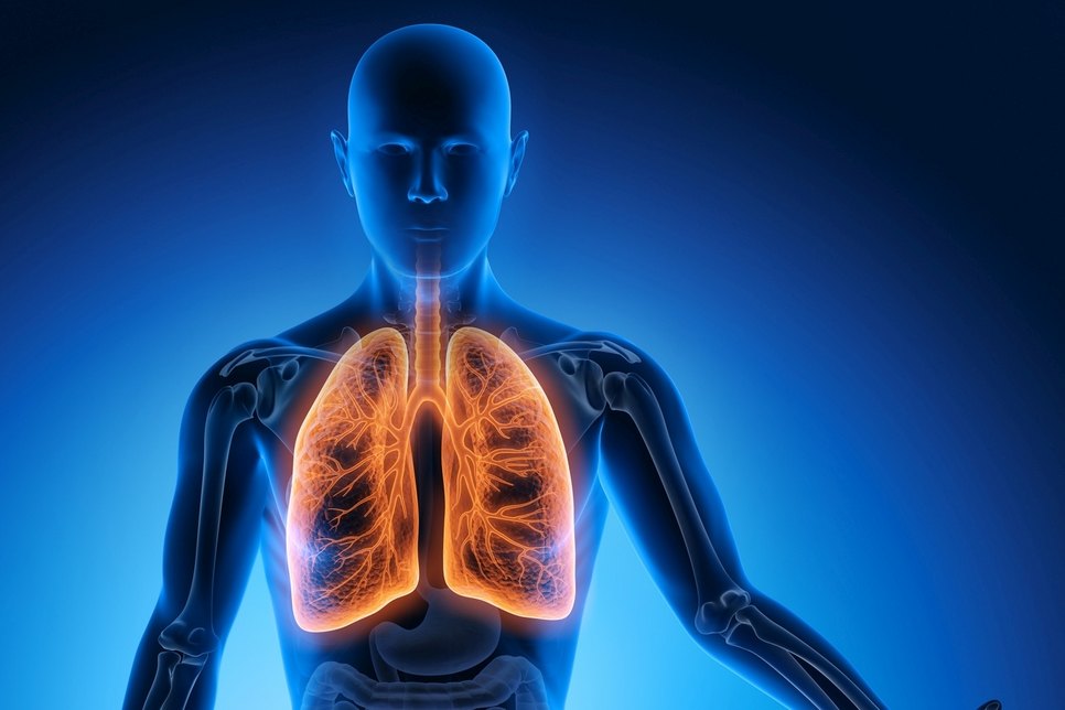 Die Infektionskrankheit Tuberkulose befällt in den meisten Fällen die Lunge. Foto: fotolia