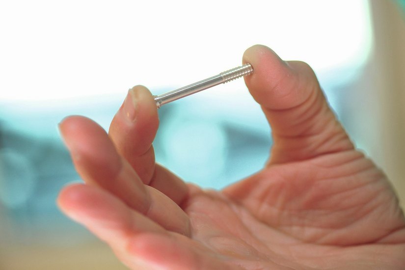 Die Magnesium-Schraube wird zur Unterstützung des Heilprozesses eingesetzt und muss nicht wieder von einem Arzt aus dem Körper entfernt werden. Foto: Syntellix AG