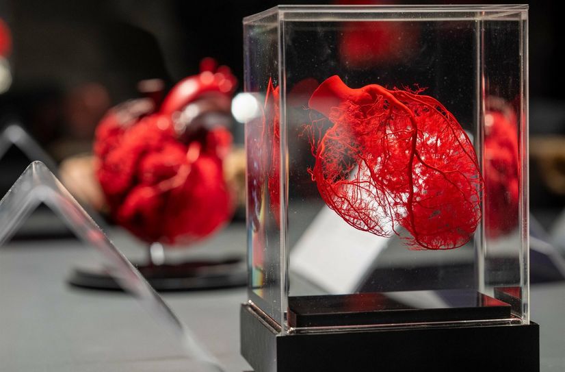 Wissenschaftlich richtig und faszinierend, das ist der Anspruch für die unzähligen Organplastinate.