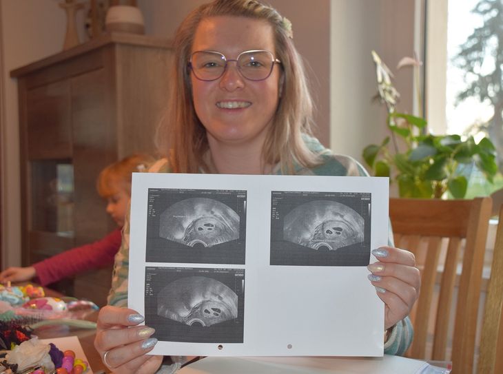 Kathleen Nahrstedt zeigt das erste Ultraschallbild, welches 2020 entstand.