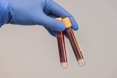 Für eine wissenschaftliche Arbeit werden an der BTU aktuell Bllutspender gesucht.